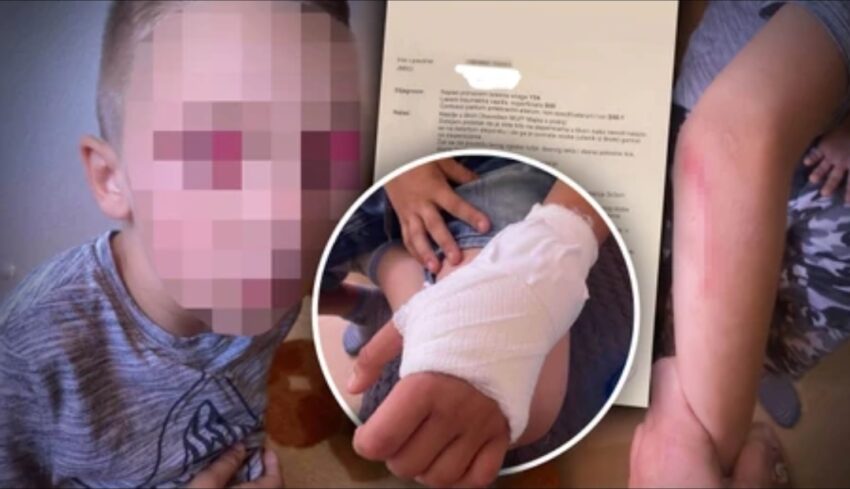 “Moj sin se plaši dece, ispisujem ga iz škole”: Oglasila se majka dečaka kojeg je drug gurnuo niz stepenice